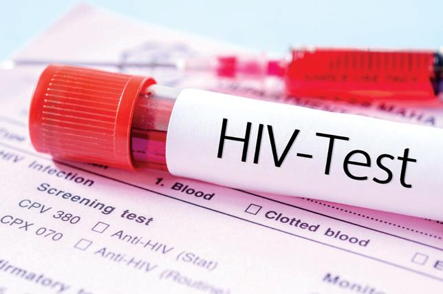 WHO unveils updated guideline on HIV service delivery